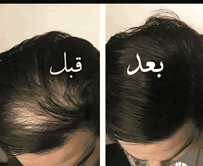 قبل وبعد 4