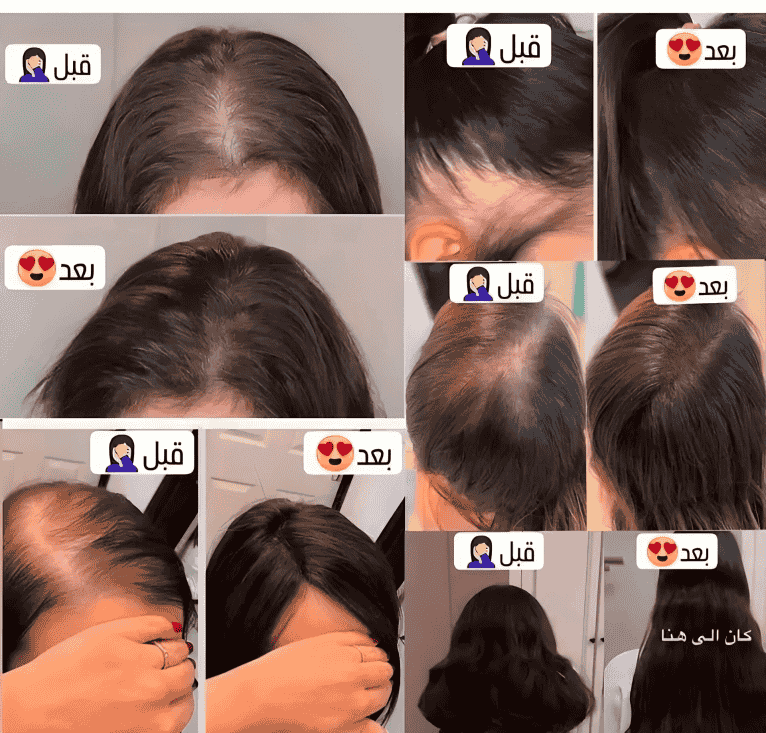 قبل وبعد 1